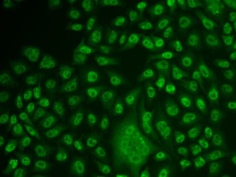 Anti-TFPT Antibody