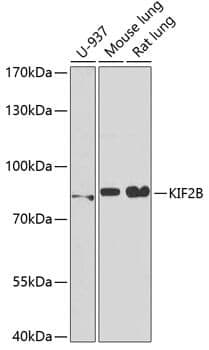 Anti-KIF2B Antibody