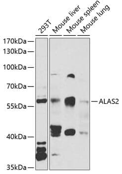 Anti-ALAS2 Antibody