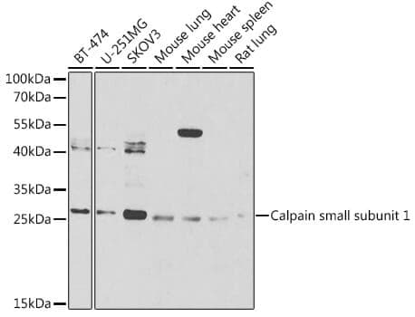 Anti-CAPNS1 Antibody
