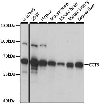 Anti-CCT3 Antibody