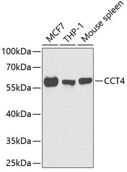 Anti-CCT4 Antibody