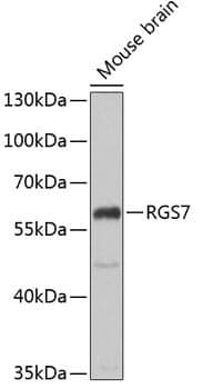 Anti-RGS7 Antibody