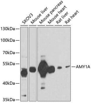 Anti-AMY1A Antibody