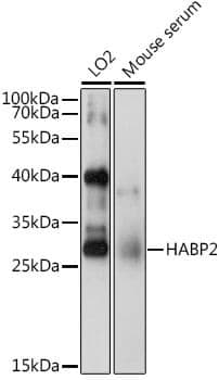 Anti-HABP2 Antibody