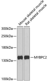 Anti-MYBPC2 Antibody