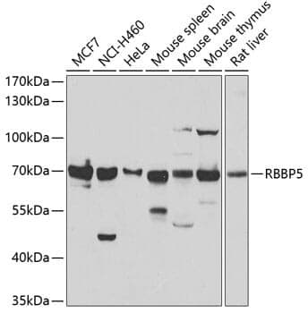 Anti-RBBP5 Antibody