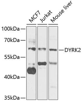 Anti-DYRK2 Antibody
