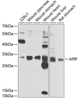Anti-APIP Antibody