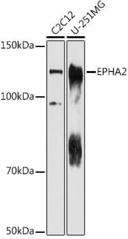 Anti-EPHA2 Antibody