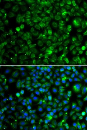 Anti-TMLHE Antibody