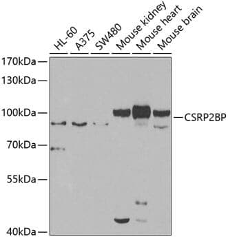 Anti-CSRP2BP Antibody