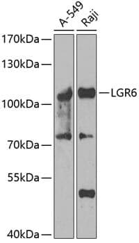 Anti-LGR6 Antibody