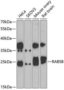 Anti-RAB5B Antibody