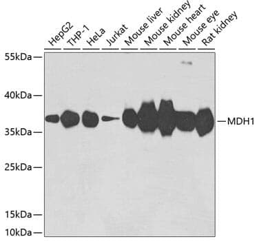 Anti-MDH1 Antibody