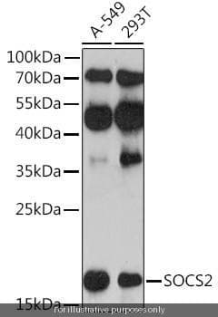 Human SOCS2 ELISA Kit