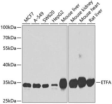Anti-ETFA Antibody