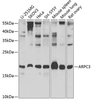 Anti-ARPC3 Antibody