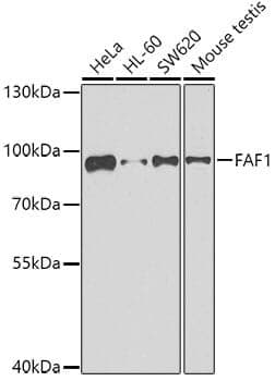 Anti-FAF1 Antibody