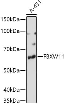 Anti-FBXW11 Antibody