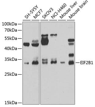 Anti-EIF2B1 Antibody