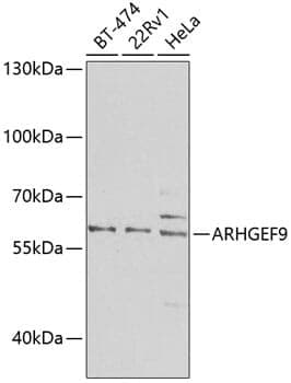 Anti-ARHGEF9 Antibody
