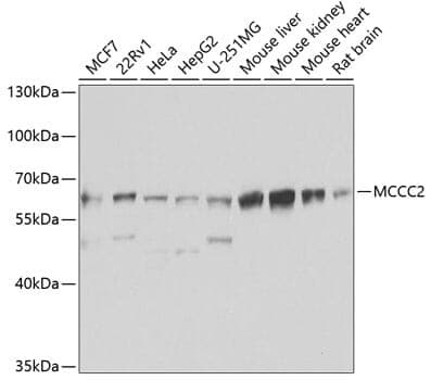 Anti-MCCC2 Antibody