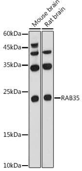 Anti-RAB35 Antibody