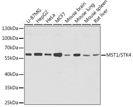 Anti-STK4 Antibody