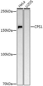 Anti-CPS1 Antibody