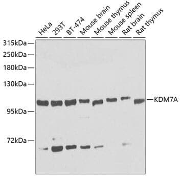 Anti-KDM7A Antibody