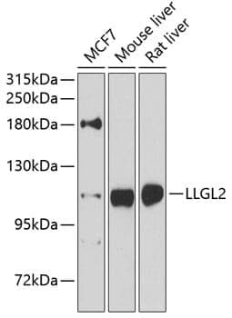 Anti-LLGL2 Antibody