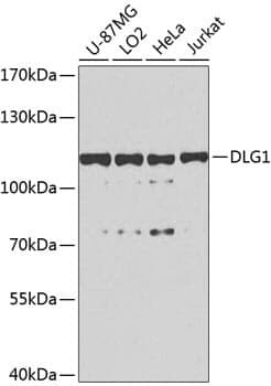 Anti-DLG1 Antibody
