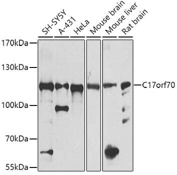 Anti-C17orf70 Antibody