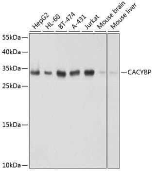 Anti-CACYBP Antibody