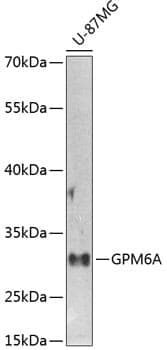 Anti-GPM6A Antibody