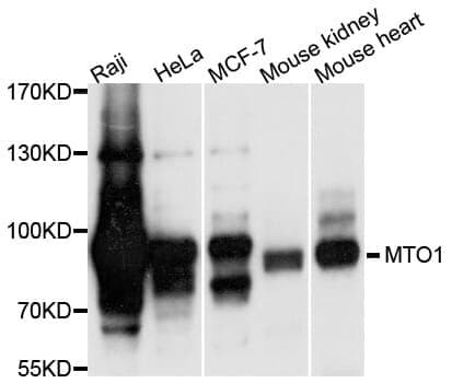 Anti-MTO1 Antibody