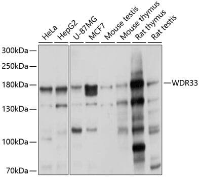 Anti-WDR33 Antibody