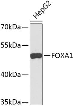 Anti-FOXA1 Antibody