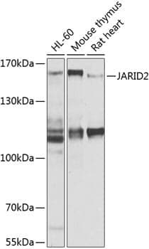 Anti-JARID2 Antibody