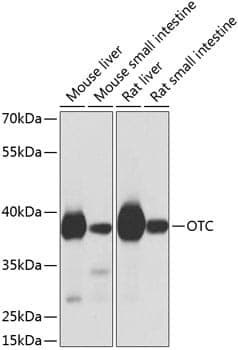Anti-OTC Antibody