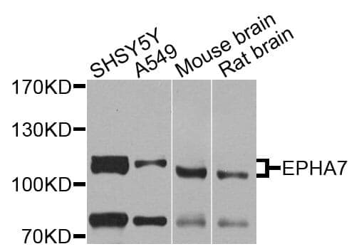 Anti-EPHA7 Antibody