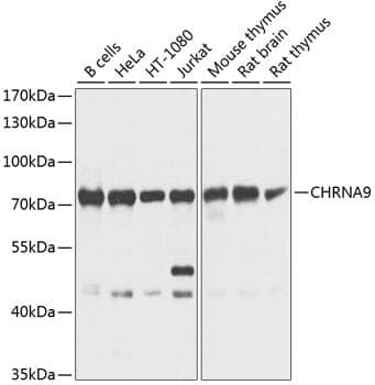 Anti-CHRNA9 Antibody