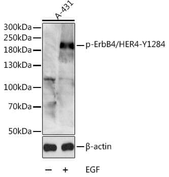Anti-ERBB4 (phospho Y1284) Antibody