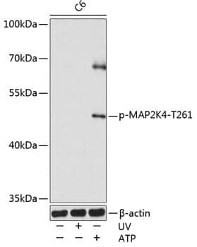 Anti-MAP2K4 (phospho T261) Antibody
