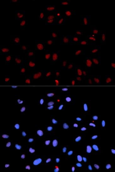 Anti-MET (phospho Y1235) Antibody