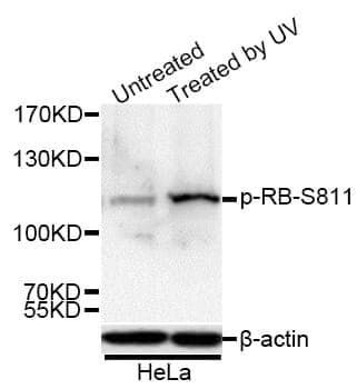 Anti-Rb (phospho S811) Antibody