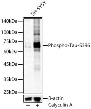 Anti-Tau (phospho S396) Antibody