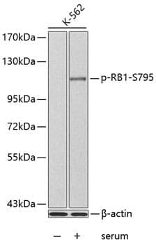 Anti-RB1 (phospho S795) Antibody