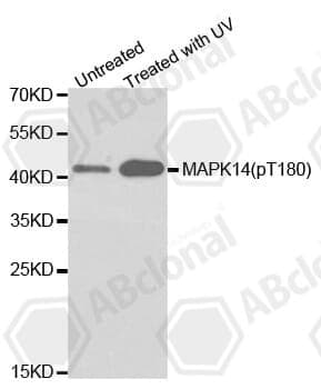 Anti-MAPK14 (phospho T180) Antibody
